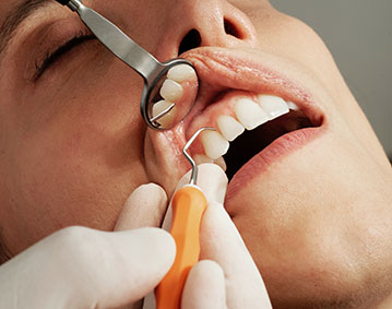 dental Emergencies